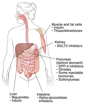 Outline of human figure showing locations where diabetes medicines work.