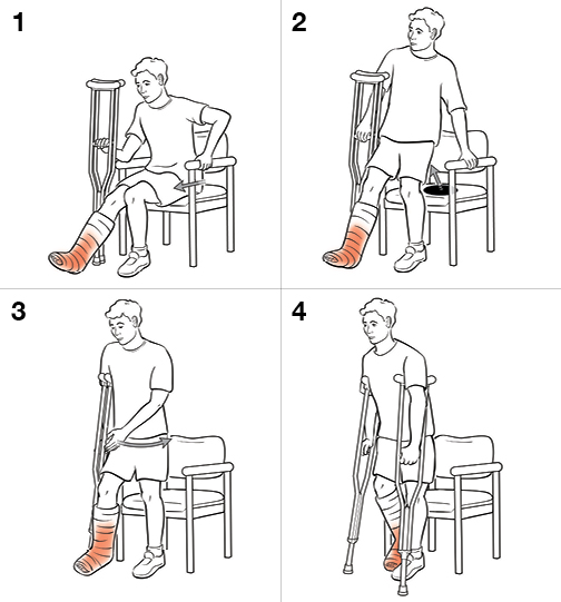 4 steps in standing with crutches (non-weight bearing).