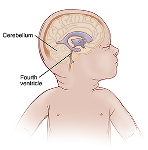 Side view of baby's head showing the cerebellum and the fourth ventricle in brain.