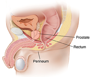 Side view cross section of male pelvis showing prostate, rectum, and perineum.